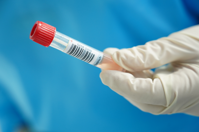 A nurse holding a tube.