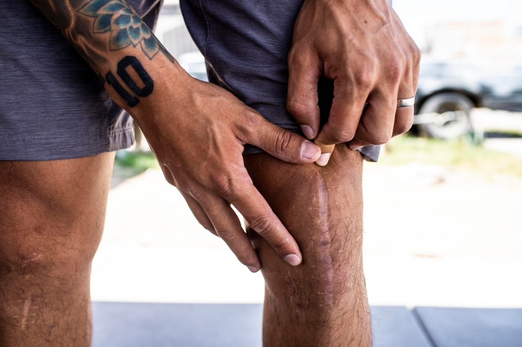 Aesculap Implant Systems to pay $38.5m to settle False Claims Act violation allegations