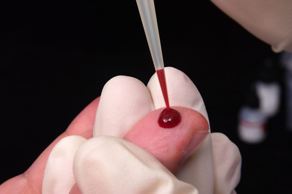 FDA issues warning letters to four companies for sale of HIV self-collection blood tests