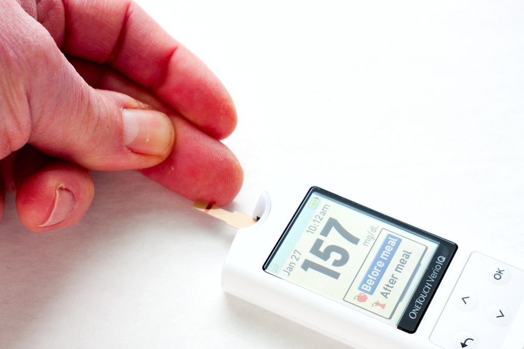 CMS and FDA unveil a fast track for Medicare access to breakthrough devices